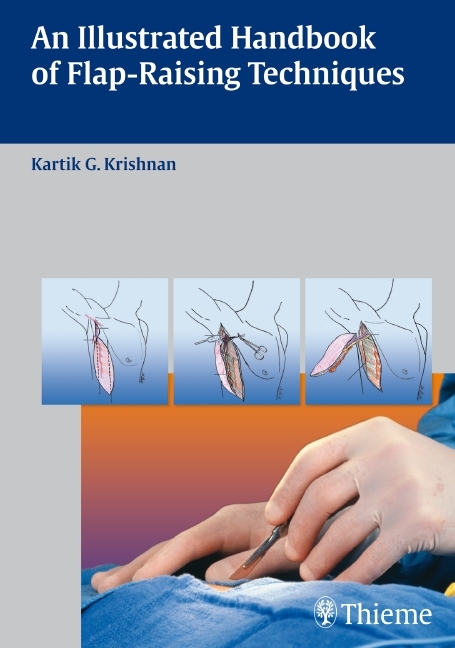 An Illustrated Handbook of Flap-Raising Techniques - Kartik G. Krishnan