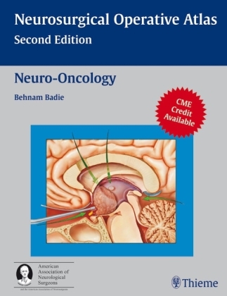 Neuro-Oncology - Benham Badie