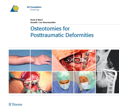 Osteotomies for Posttraumatic Deformities - René K. Marti, Ronald J. van Heerwaarden