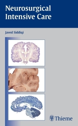 Neurosurgical Intensive Care -  Javed Siddiqi