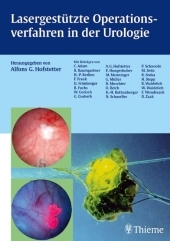 Lasergestütze Operationsverfahren in der Urologie - 