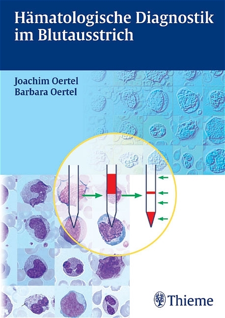 Hämatologische Diagnostik im Blutausstrich - Joachim Oertel, Barbara Oertel