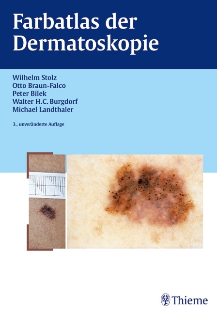 Farbatlas der Dermatoskopie - Wilhelm Stolz, Otto Braun-Falco, Peter Bilek