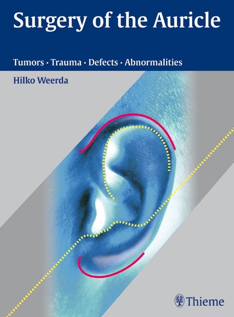 Surgery of the Auricle - Hilko Weerda