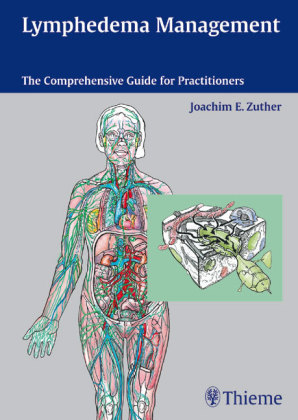 Lymphedema Management - Joachim Joachim E. Zuther