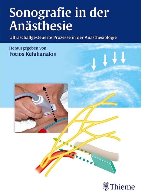 Sonografie (sic!) in der Anästhesie - Fotios Kefalianakis