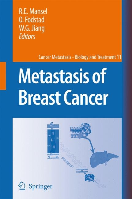 Metastasis of Breast Cancer - R E Mansel