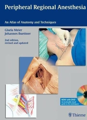 Peripheral Regional Anesthesia - Gisela Meier, Johannes Buettner, Johannes Büttner