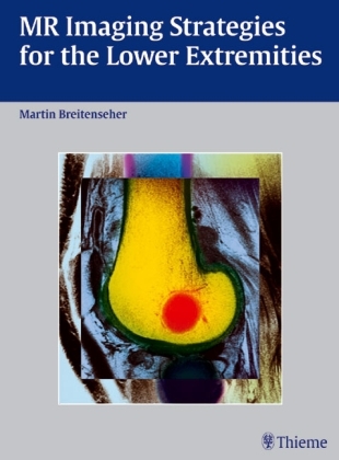 MR Imaging Strategies for the Lower Extremities - Martin Breitenseher