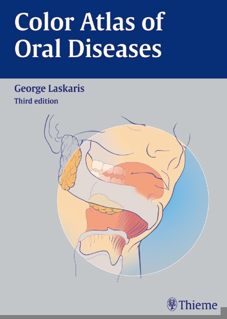 Color Atlas of Oral Diseases - George Laskaris