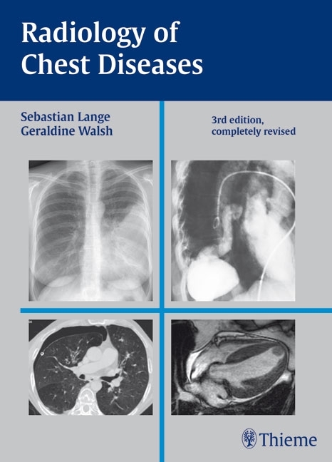 Radiology of Chest Diseases - Sebastian Lange, Geraldine Walsh