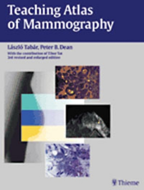 Teaching Atlas of Mammography - Peter B. Dean, Laszlo Tabar, Tibor Tot