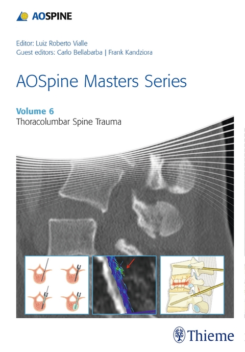 AOSpine Masters Series, Volume 6: Thoracolumbar Spine Trauma