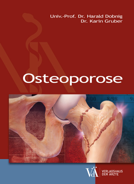 Osteoporose - Harald Dobnig, Karin Gruber