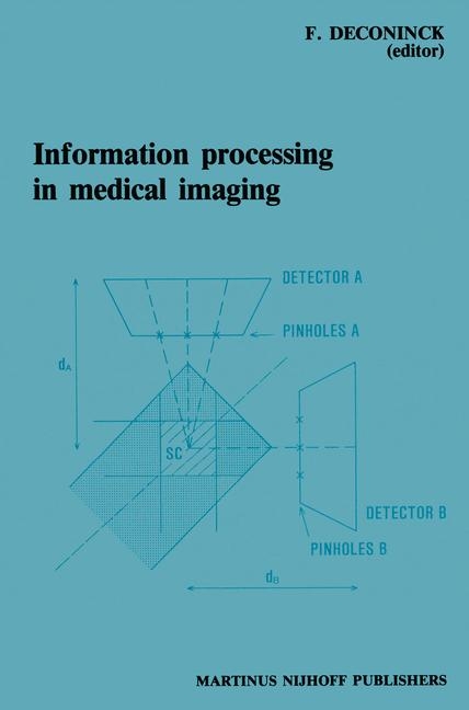 Information Processing in Medical Imaging - 