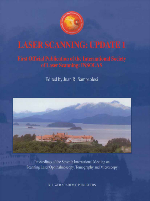 Laser Scanning: Update 1 - 