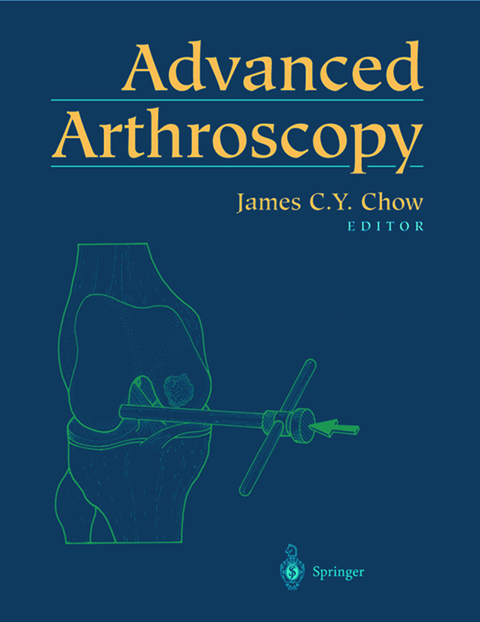 Advanced Arthroscopy - 