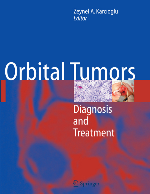 Orbital Tumors - 