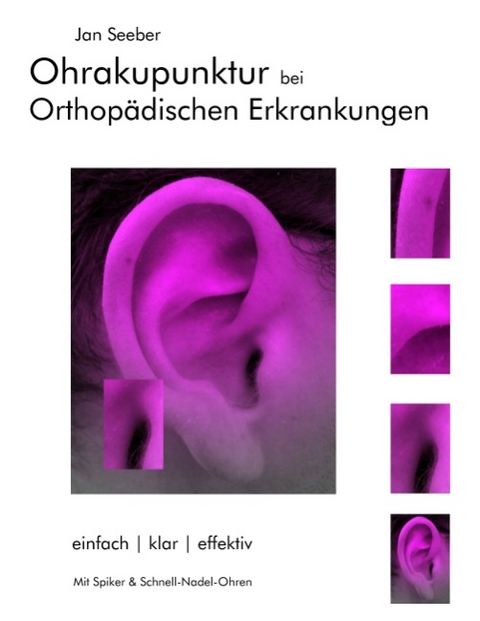 Ohrakupunktur bei Orthopädischen Erkrankungen - Jan Seeber