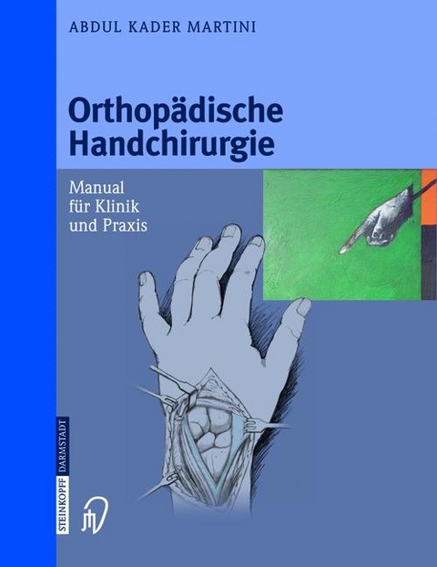 Orthopädische Handchirurgie - A. K. Martini