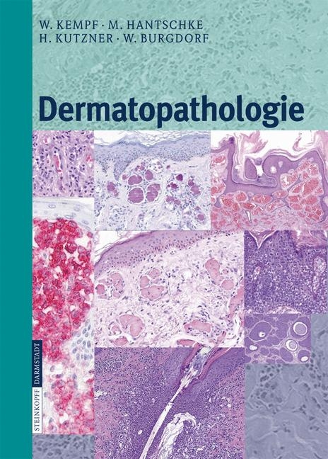 Dermatopathologie - W. Kempf, M. Hantschke, H. Kutzner, W. Burgdorf