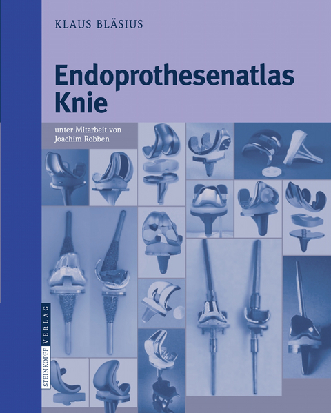 Endoprothesenatlas Knie - Klaus Bläsius