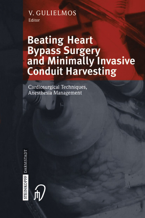 Beating Heart Bypass Surgery and Minimally Invasive Conduit Harvesting - 