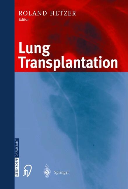 Lung Transplantation - 