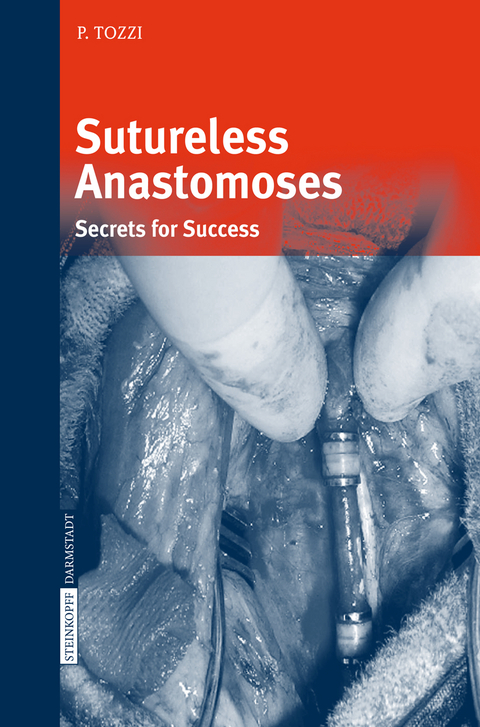 Sutureless Anastomoses - Piergiorgio Tozzi