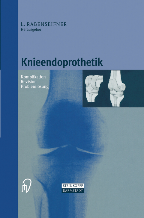 Knieendoprothetik - 