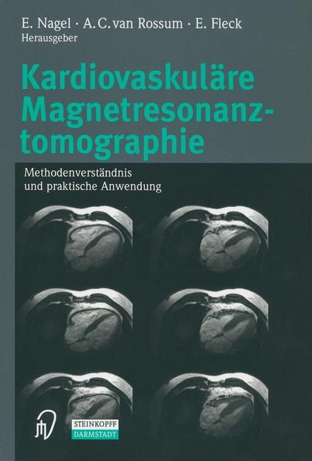 Kardiovaskuläre Magnetresonanztomographie - 