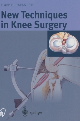 New Techniques in Knee Surgery - H.H. Paessler