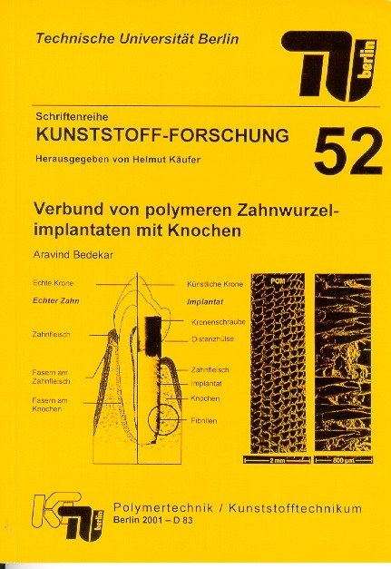 Verbund von polymeren Zahnwurzelimplantaten mit Knochen - Aravind Bedekar