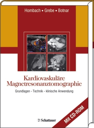 Kardiovaskuläre Magnetresonanztomographie - 