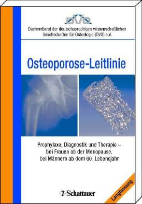 Evidenzbasierte Konsensus-Leitlinie zur Osteoporose