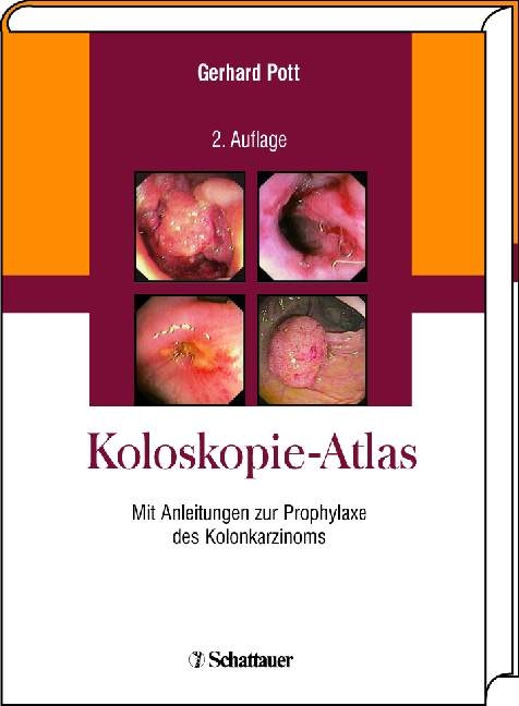 Koloskopie-Atlas - Gerhard Pott