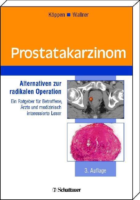 Prostatakarzinom - Ulrich Köppen, Kent Wallner