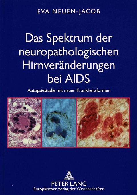 Das Spektrum der neuropathologischen Hirnveränderungen bei AIDS - Eva Neuen-Jacob