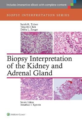 Biopsy Interpretation of the Kidney & Adrenal Gland - Satish Tickoo, Ying-Bei Chen, Debra Zynger