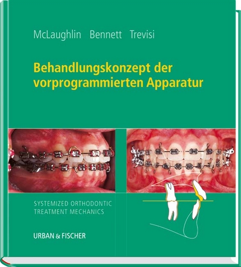 Behandlungskonzept der vorprogrammierten Apparatur - Richard P McLaughlin, John C Bennett, Hugo J Trevisi