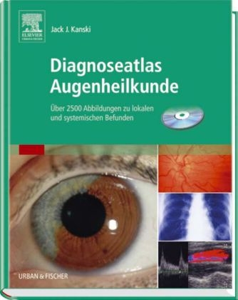 Diagnoseatlas Augenheilkunde - 