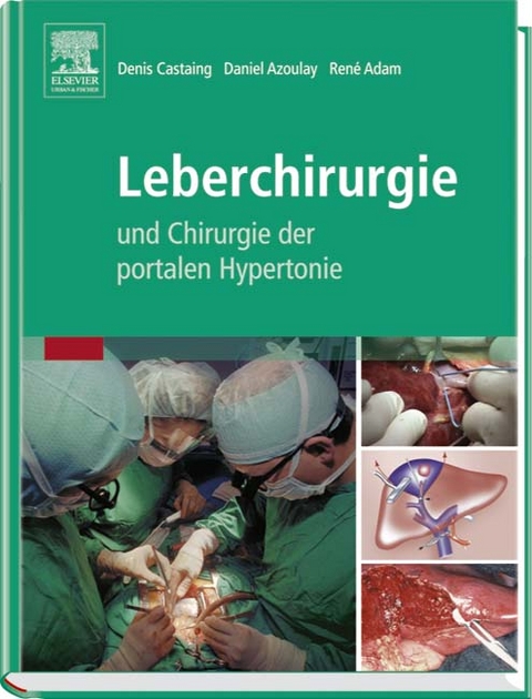 Leberchirurgie - 