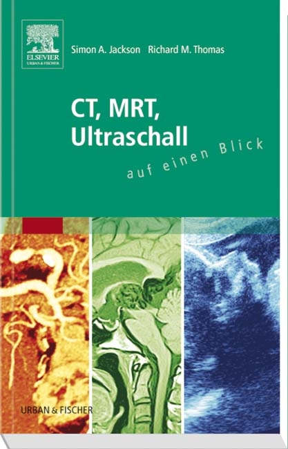 CT, MRT, Ultraschall auf einen Blick - Simon A. Jackson, Richard M. Thomas