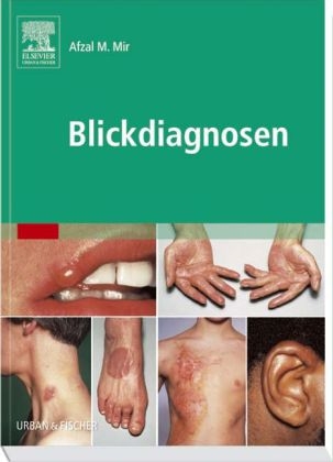 Blickdiagnosen - Afzal M Mir