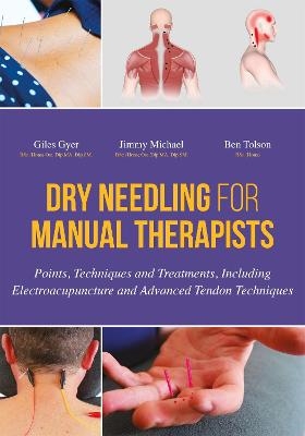 Dry Needling for Manual Therapists - Giles Gyer, Jimmy Michael, Ben Tolson