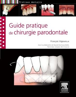 Guide Pratique de Chirurgie Parodontale - Francois Vigouroux