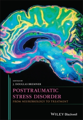 Posttraumatic Stress Disorder - J. Douglas Bremner