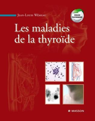 Les Maladies de la Thyroïde - Jean-Louis Wemeau