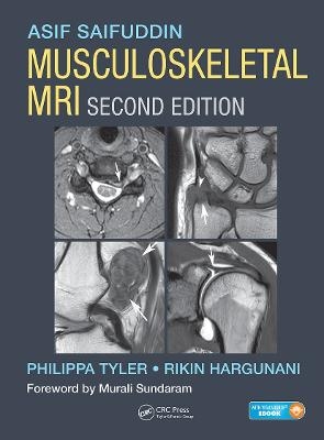 Musculoskeletal MRI - Asif Saifuddin, Philippa Tyler, Rikin Hargunani