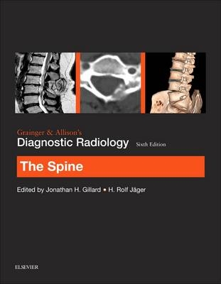 Grainger & Allison's Diagnostic Radiology: The Spine - Jonathan H Gillard, H. Rolf Jager